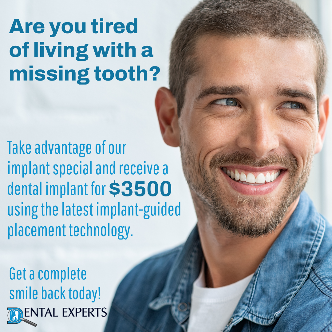 Dental Implants Special